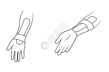手腕草图矢量插图上的Kinesilogy治疗运动带康复身体绷带运动机疗法保健手臂伤害理疗师成人图片