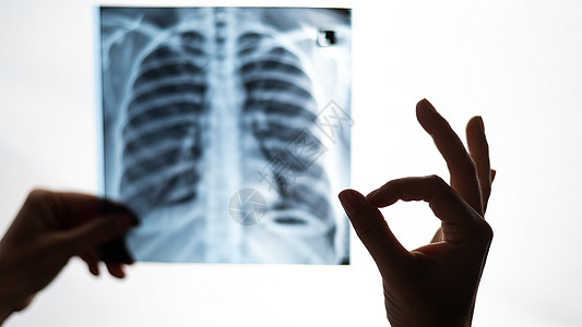 医生检查病人肺部的X光片 并显示确定信号射线肺炎手臂透视诊所流感考试快照方法放射科图片