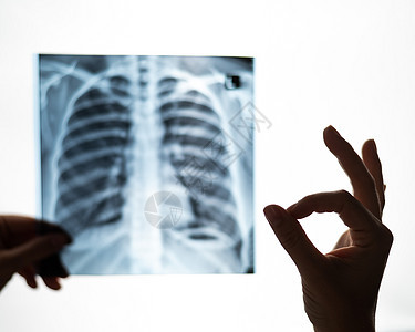 医生检查病人肺部的X光片 并显示确定信号胸部诊所医师肺炎展示射线咨询诊断x光女性图片