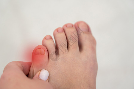 红点女性脚的火焰 脚痛和疾病的概念妇女脚部炎热 红点伤害风湿病扭伤痛苦女士脚趾手指风湿骨科疼痛背景图片
