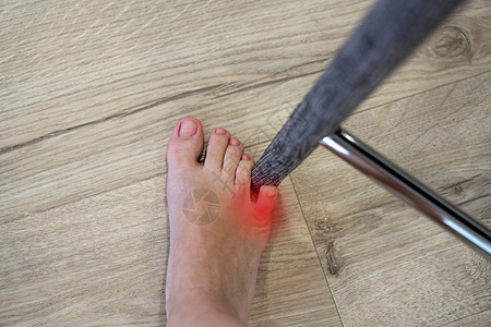 女人用小脚趾打椅子 家里出事了 红点显示小脚指受伤痛苦扭伤事故趾甲赤脚皮肤女士手指指甲创伤图片