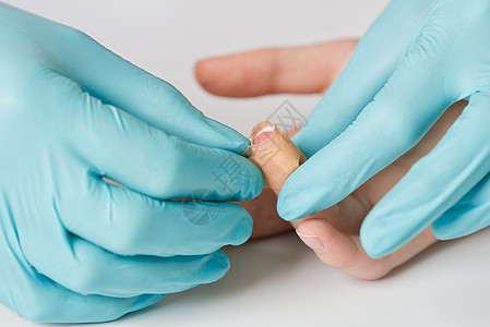 医生把医用粘合胶带防水剂贴在手指伤口上的石膏上帮助事故援助磁带皮肤疼痛推杆医疗白色乐队图片