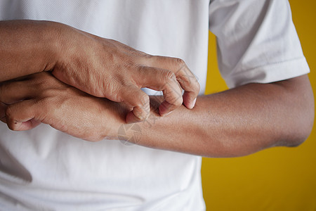 男人有痒皮肤 紧闭痛苦过敏划痕发痒疼痛皮疹手指疾病细菌男性图片