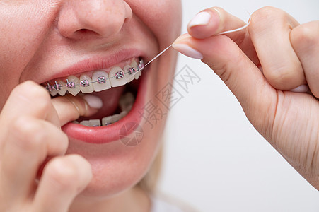 白种女人用牙套打扫牙齿 用牙线擦牙 剪裁肖像药品诊所微笑喜悦治疗口服女性牙医化妆品病人图片