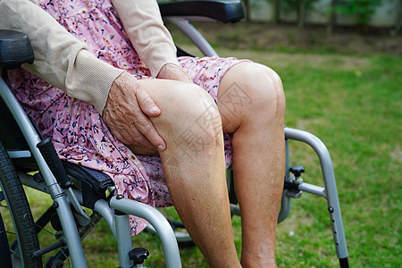 患有伤疤替代膝盖手术的亚裔老年妇女在医院接受治疗瘢痕成人身体疼痛情况女性解剖学主食伤口病人图片
