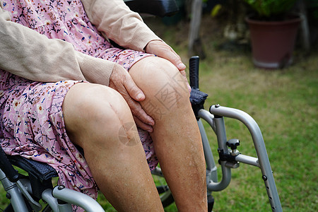 患有伤疤替代膝盖手术的亚裔老年妇女在医院接受治疗护理女性主食肌腱关节替代品皮肤疼痛身体金属图片