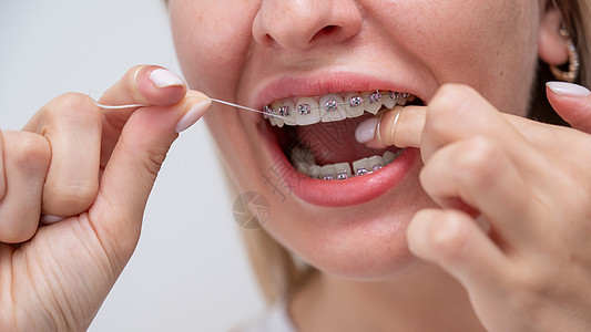 白种女人用牙套打扫牙齿 用牙线擦牙 剪裁肖像病人牙刷牙科喜悦治疗药品化妆品金发呼吸快乐图片