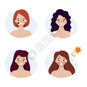 患有各种皮肤疾病的妇女 脸上有发炎和过敏症状太阳插图治疗胎记晒斑药品英雄女孩青年粉刺图片