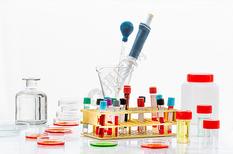 实验室分析研究带有血样和尿样的试管和培养皿 用于在白色实验室的桌子上进行分析化学品样本药店科学大学医院药品科学家器皿样品图片