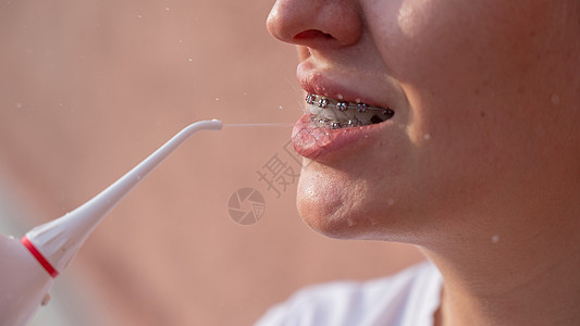 牙齿上有牙套的女人用的是喷水器 近身肖像矫正灌水器牙科女性打扫牙线牙刷喷射保健口服图片