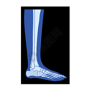 射线脚腿骨骼 腓骨 胫骨-指骨人体 骨骼成人伦琴侧视图 3D逼真平面图片
