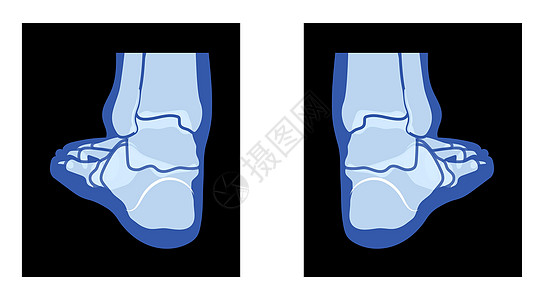 射线脚腿骨骼人体骨骼-踝骨 趾骨成人伦琴后视图 现实的平蓝色图片