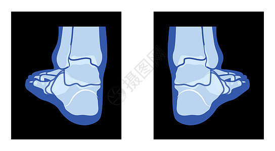 射线脚腿骨骼人体骨骼-踝骨 趾骨成人伦琴后视图 现实的平蓝色图片