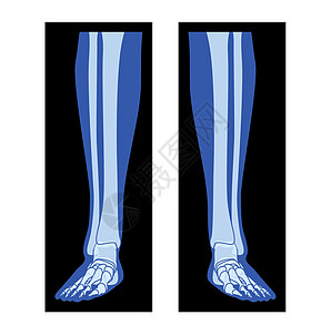 X Ray 脚脚腿尖尖 Fibula 人体 Bones成年人的伦琴前视3D现实公寓图片