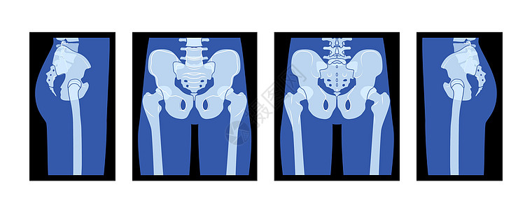 一组X-雷射Pelvis和人类身体 Bones成年成人图片