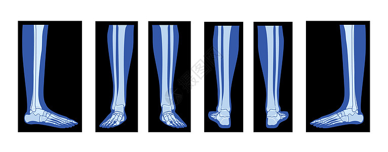 一组X光脚脚腿斯凯勒顿人的身体 骨骼成年人的伦琴前侧视角图片