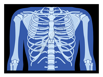 射线胸腔和手骨架人体骨骼成人伦琴前视图 3D 逼真平蓝色概念图片
