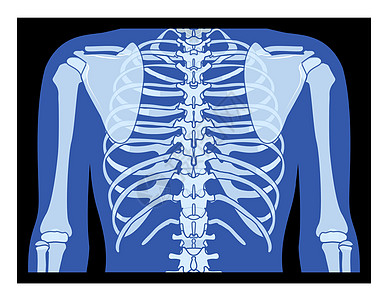 XRay 肋骨笼子和手 Skeleton 人体骨质骨质成年人 伦琴回视图片