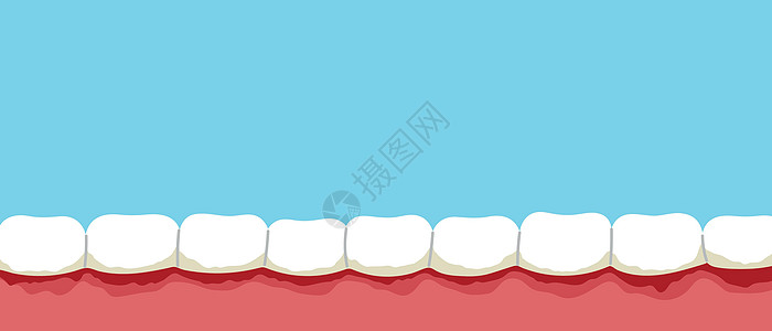 Gum 疾病卡通横幅 周期性炎 口香糖出血 牙齿上的板块图片