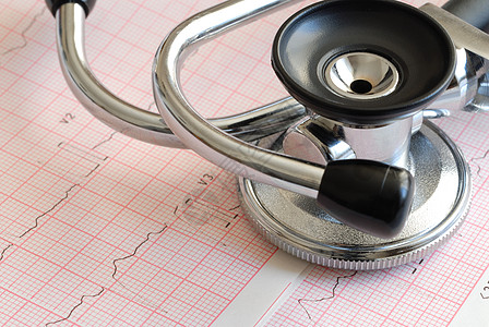立管镜和ECG医疗卫生保健图表考试脉冲乐器心脏病学心电图背景图片