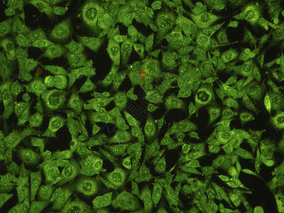 人类肺癌细胞药店染色体疾病显微镜生物学生物危险微生物学科学绿色图片