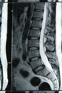 MRI 结果1图片