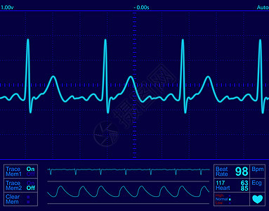心脏监测屏幕信号监控蓝色医生测试病人诊断诊所疾病情况图片