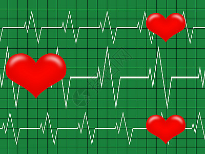 心医生阀门肌肉测试心脏病学高血压步伐药品外科中风图片