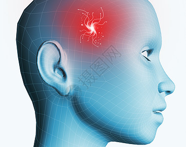 头痛伤害扫描仪智力神经症疾病医疗蓝色头脑药品女士图片