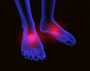 脚足和疼痛电脑科学风湿病生物学药品解剖学插图x光脚趾骨骼图片