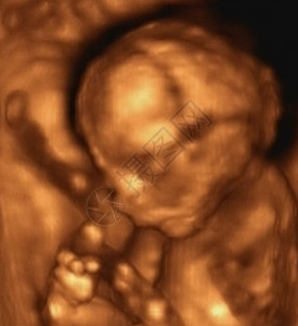 三度超声波机器检查怀孕疾病婴儿医院药品男人控制诊断图片
