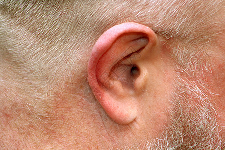 人类耳朵皮肤听力解剖学头发身体探测器耳廓运河宏观平衡图片