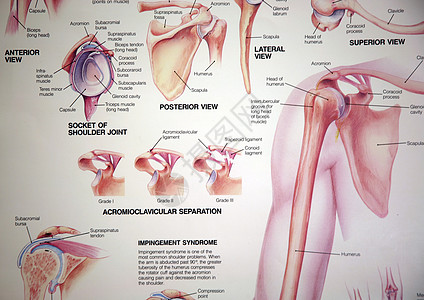 医疗肩表图片