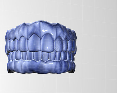 假记镜子技术卫生牙科金属探测保健牙龈假牙工具图片