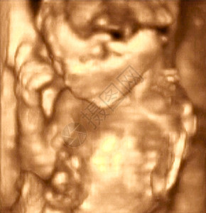 对四月四月胎儿的超声波分析科学考试生活药品女性女士射线扫描测试微笑图片