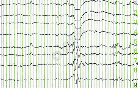 电子脑电图心脑余弦生活屏幕频率标志科学电极药品脉冲图片