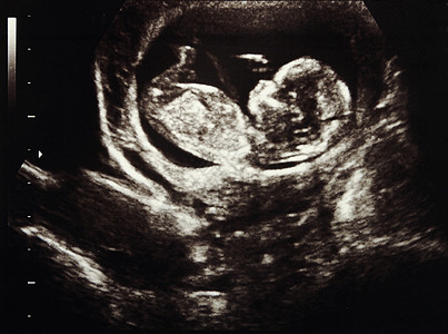 超声怀孕母性技术胎儿生活药品女性科学孩子扫描腹部图片