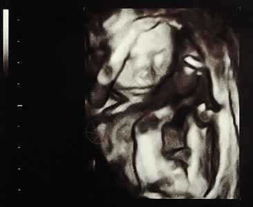 超声怀孕腹部声呐医疗科学子宫母性女性生活脐带孩子图片