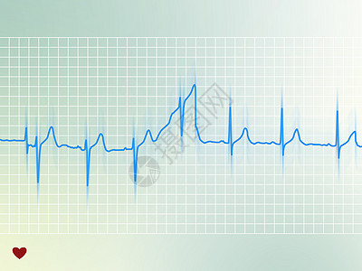 心电组测试计算机心脏病学状况波形卫生保健医生脉冲频率背景图片