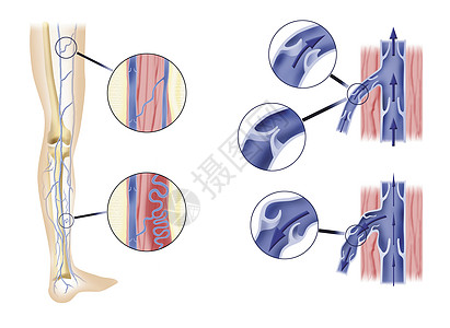腿动脉和动动脉阀门图片
