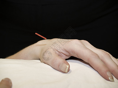 针针针刺概念肌肉药品幸福病人疼痛治疗师健康福利物理医疗图片