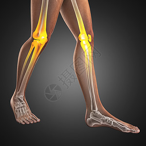 人类放射摄影扫描放射科药品膝盖科学手术照相肋骨x光考试风湿病图片