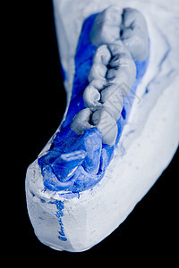 人体牙齿 型号空腔科学卫生假牙模具牙科矫正假肢磨牙药品图片