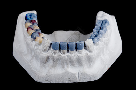 人体牙齿 型号模具牙医身体矫正科学石膏牙科口腔科磨牙教育图片