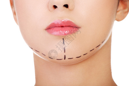 女人被标记为化妆外科手术魅力皱纹保健医生塑料嘴唇皮肤美容师治疗程序图片