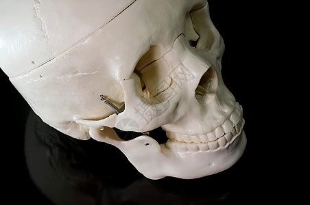 黑色背景的骨骼筛骨裂缝医生翼点骨头上颌骨软骨颅骨蝶骨整骨图片