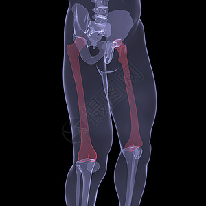 人腿X光髂骨拐杖骨骼医生科学身体肋骨膝盖骨头躯干图片