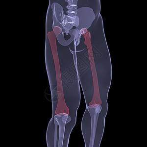 人腿X光髂骨拐杖骨骼医生科学身体肋骨膝盖骨头躯干图片