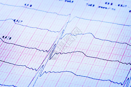 纸上的心脏心电图图片