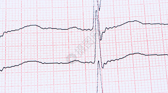 纸上的心电图图片